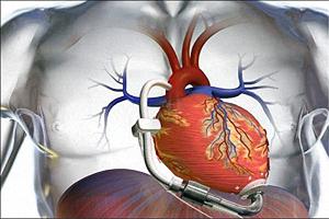 تولید بافت‌های مصنوعی قلب
