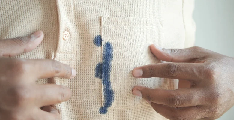 انواع لکه‌ پارچه